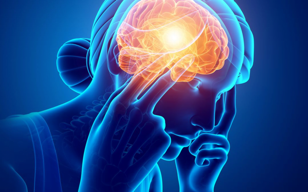 migraine